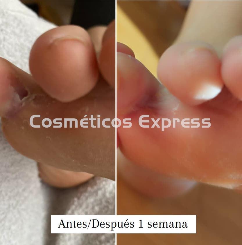 FeetCalm Mousse SOS Reparadora - Imagen 2