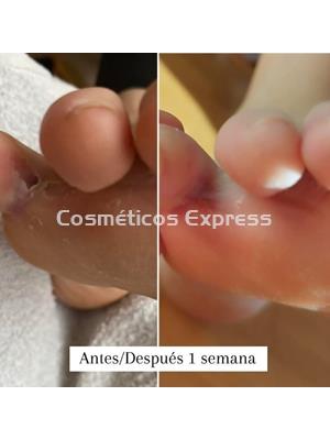 FeetCalm Mousse SOS Reparadora - Imagen 2