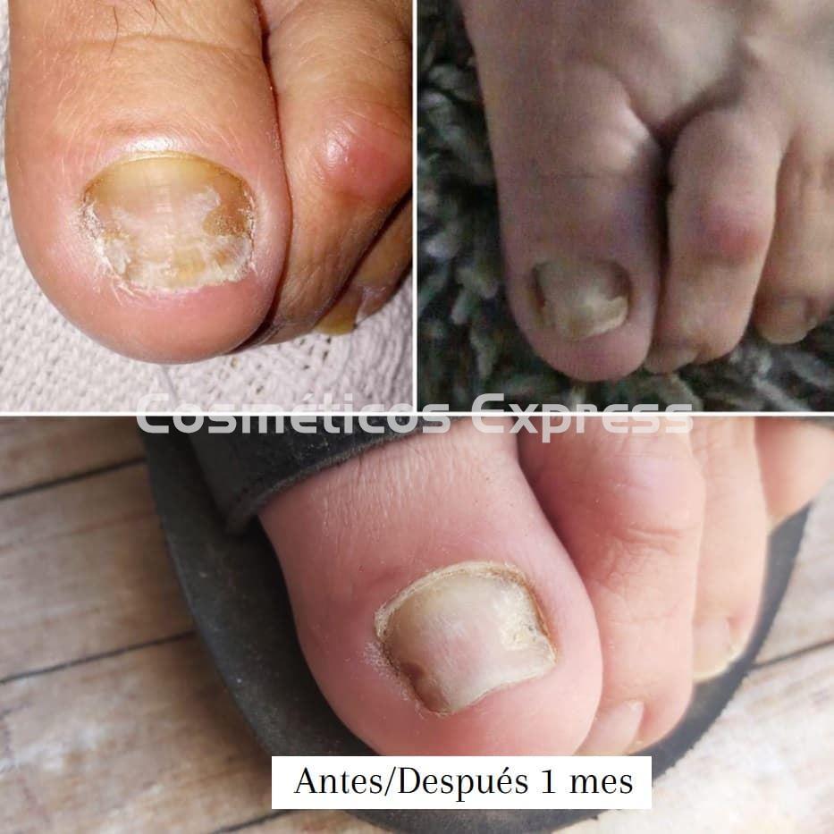 FeetCalm Spray SOS Reparador Uñas - Imagen 2