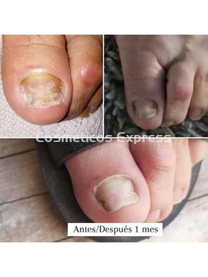 FeetCalm Spray SOS Reparador Uñas - Imagen 2