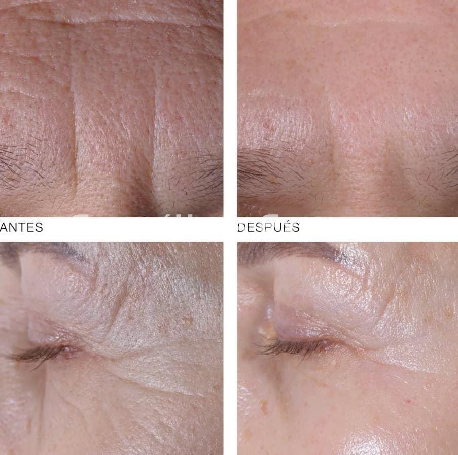 Germaine de Capuccini Pro-Colágeno Ojos y Labios Timexpert Wrink·Less - Imagen 2
