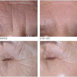 Germaine de Capuccini Pro-Colágeno Ojos y Labios Timexpert Wrink·Less - Imagen 2