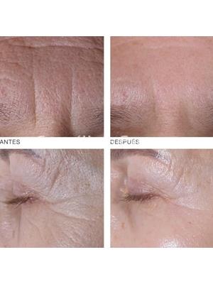 Germaine de Capuccini Pro-Colágeno Ojos y Labios Timexpert Wrink·Less - Imagen 2