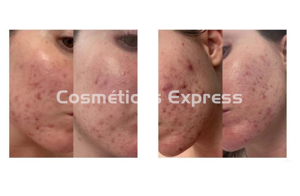 Isséimi Crema Purificante con Ozono O3 Depur - Imagen 2