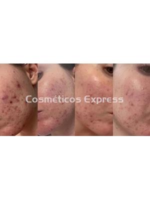 Isséimi Crema Purificante con Ozono O3 Depur - Imagen 2